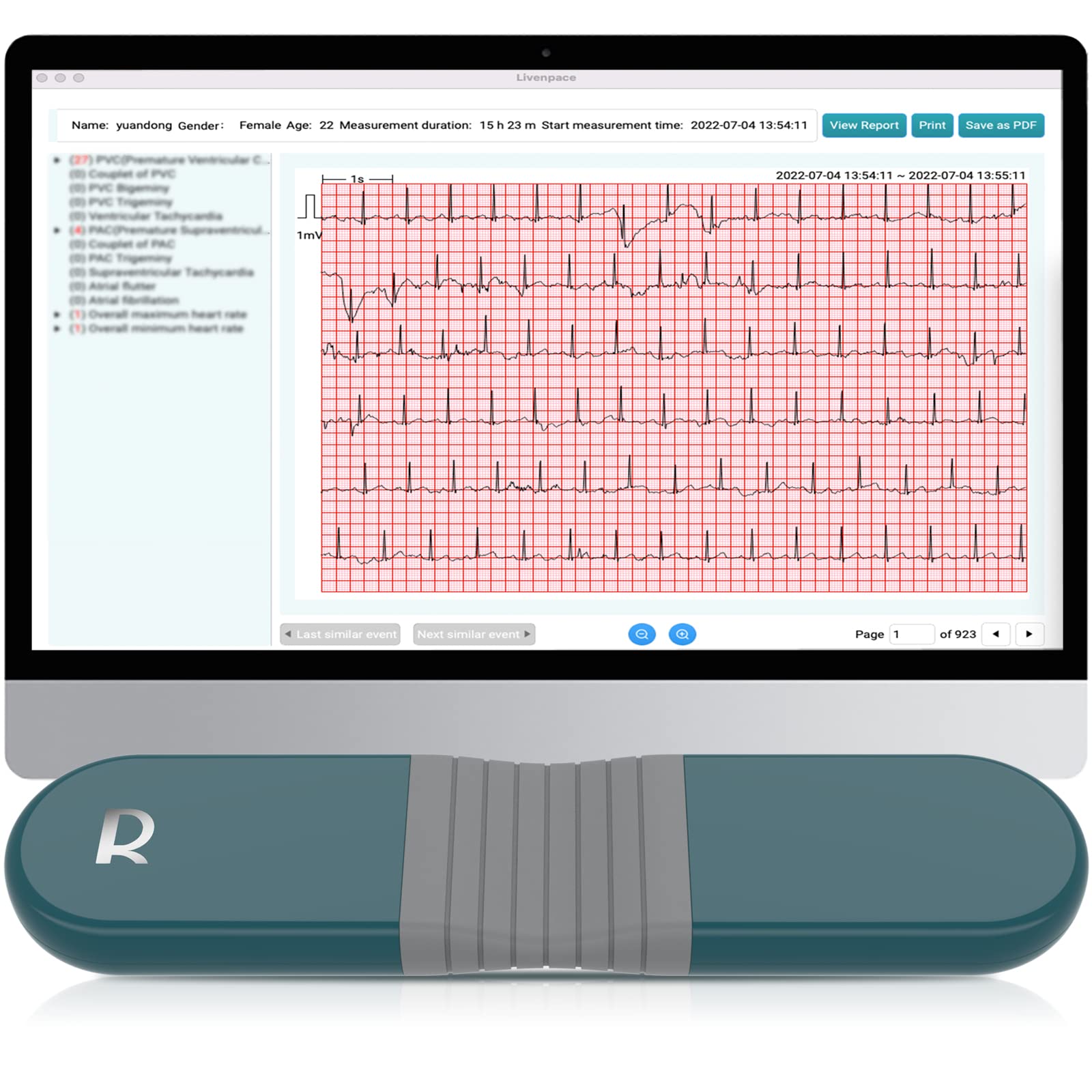 AI HR Monitor, 24 Hours Chest Lead Device with Free AI Analysis & PC Report, Chargeable Recorder, HHM1